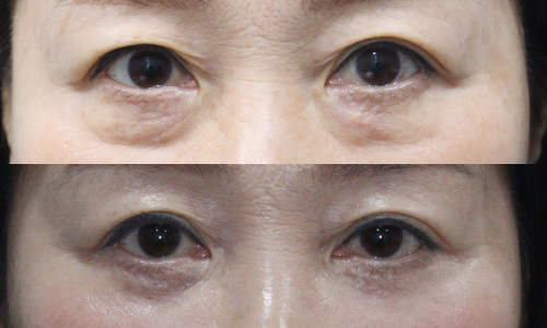 슬라이드10